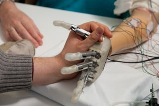 Бионическая рука позволяет пациенту «чувствовать»